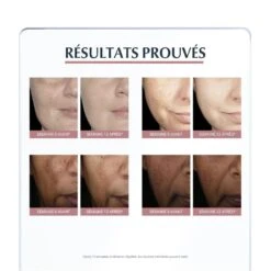 Cura Della Notte 50ml Anti-Pigment Eucerin 8 Cura Della Notte 50ml Anti-Pigment Eucerin -Corpo Vita Vendite 111850