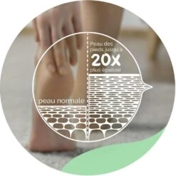 Crema Idratante Quotidiana Per I Piedi 150 Ml Expert Care Pelle Da Normale A Secca Scholl -Corpo Vita Vendite 114913