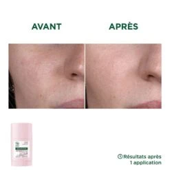 Maschera Stick Lenitiva Biologica Per Pelli Sensibili 25g Pivoine Klorane 9 Maschera Stick Lenitiva Biologica Per Pelli Sensibili 25g Pivoine Klorane -Corpo Vita Vendite 119067