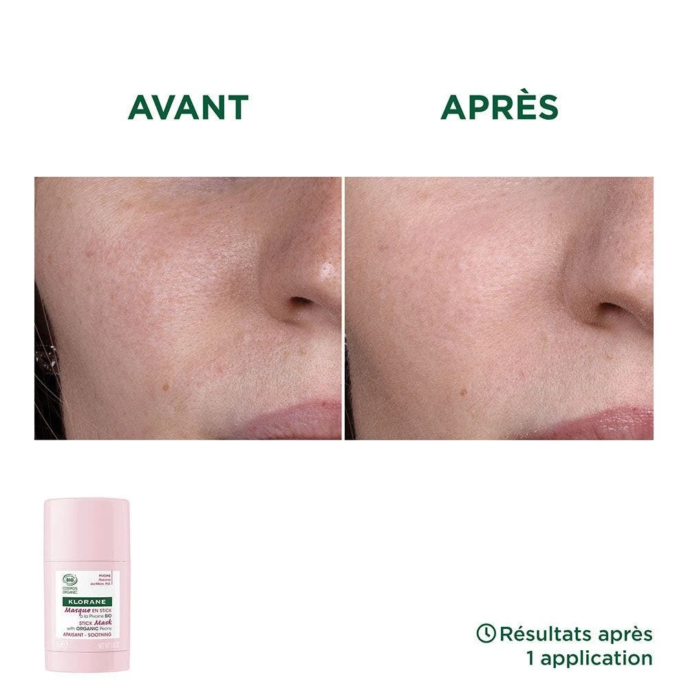 Maschera Stick Lenitiva Biologica Per Pelli Sensibili 25g Pivoine Klorane 5 Maschera Stick Lenitiva Biologica Per Pelli Sensibili 25g Pivoine Klorane - immagine 5