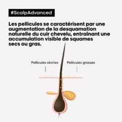 Shampoo Antiforfora Dermo-chiarificante 300 Ml Scalp Advanced L'Oréal Professionnel -Corpo Vita Vendite 121511