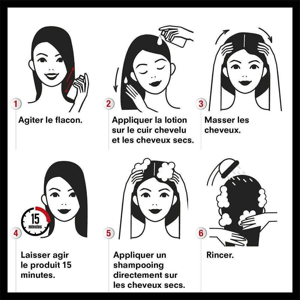 Trattamento Contro Pidocchi E Lendini 100ml XF Pouxit 5 Trattamento Contro Pidocchi E Lendini 100ml XF Pouxit - immagine 5