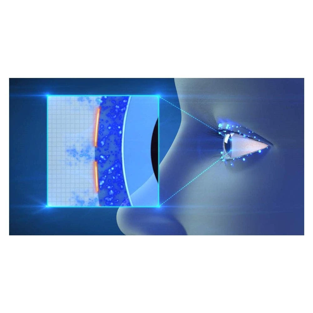 Actimist 2in1 Spray Per Occhi Irritati 10ml Optone 2 Actimist 2in1 Spray Per Occhi Irritati 10ml Optone - immagine 2